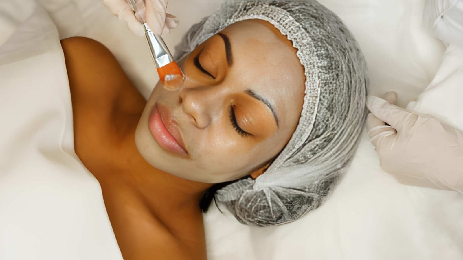 TCA Peel (Face)